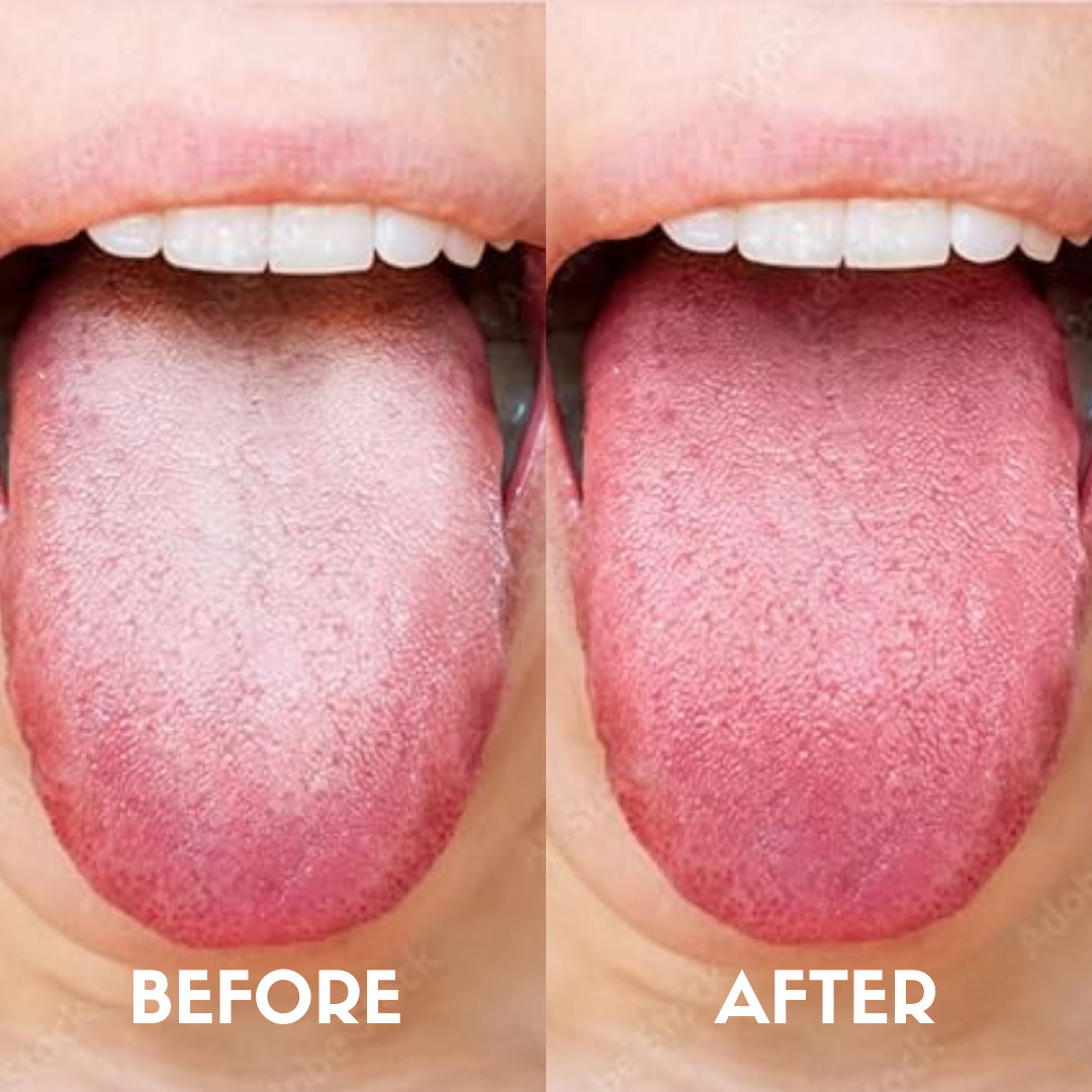 Ayurvedic Coconut Oil for Oil Pulling with Copper Tongue Cleaner