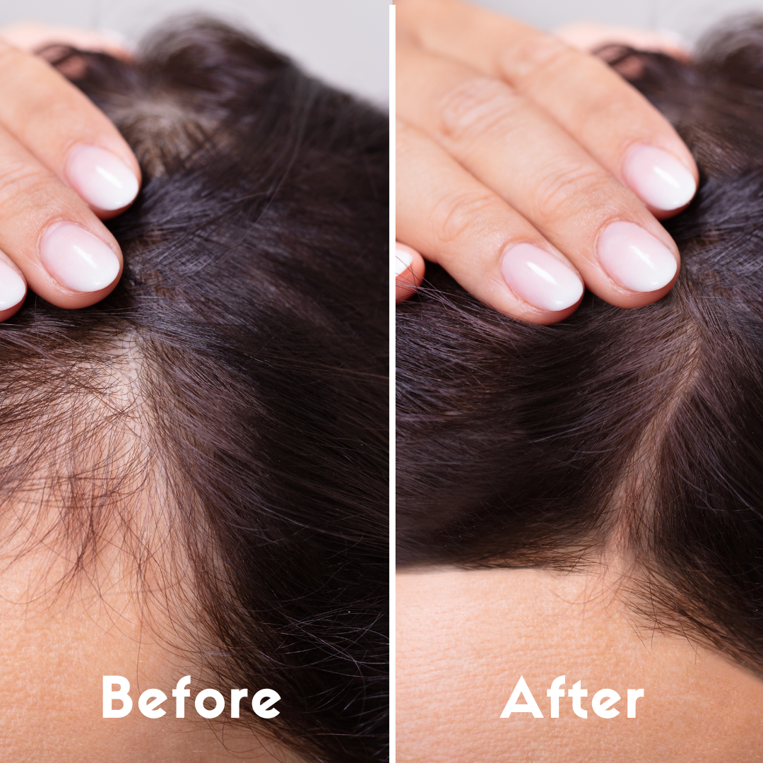 Adivasi Herbal Hair Oil, Goodness of 12 Ayurvedic Herbs