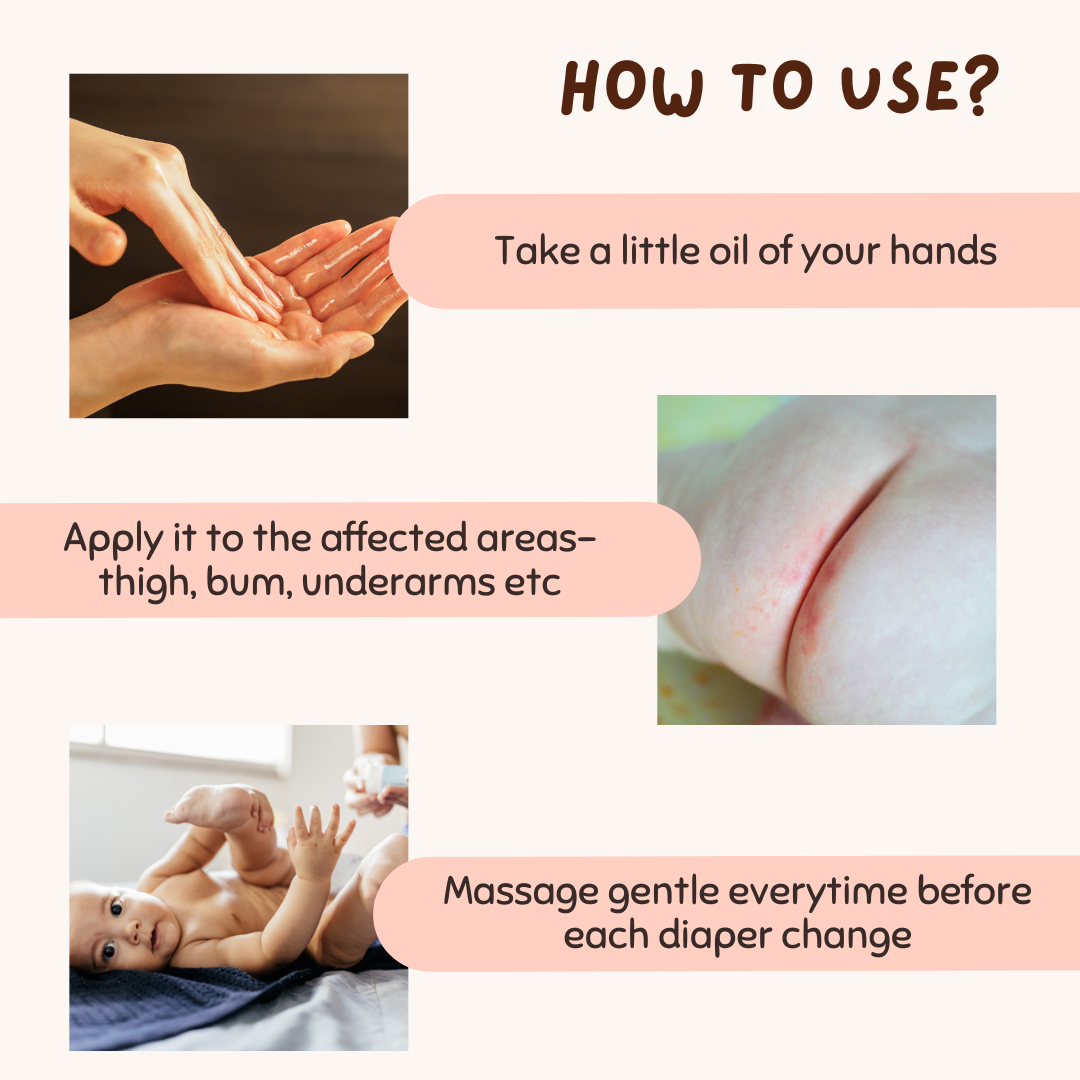 Rash Oil for Babies - Diaper & Nappy Rash Relief