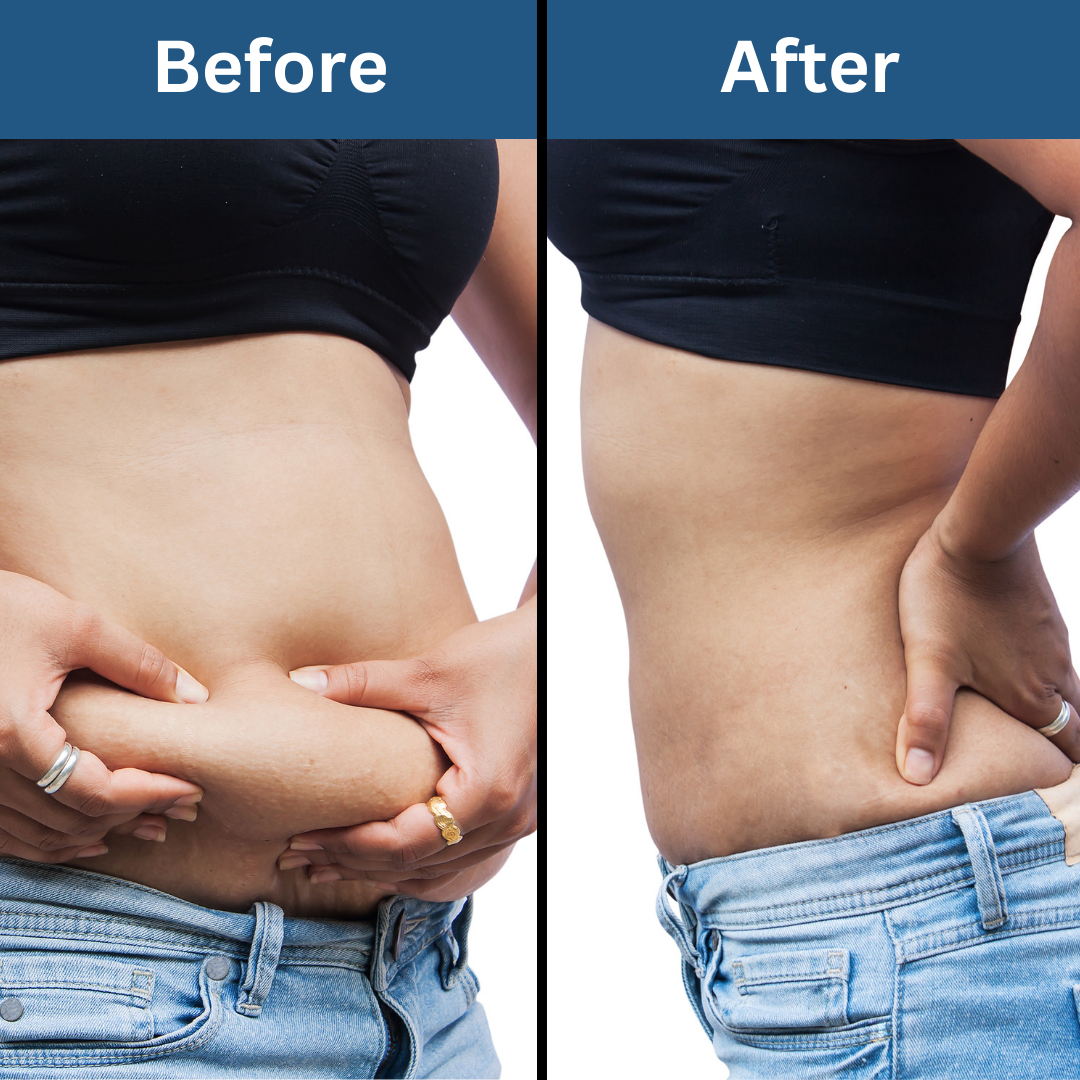 Body Toning & Sculpting Massage Oil