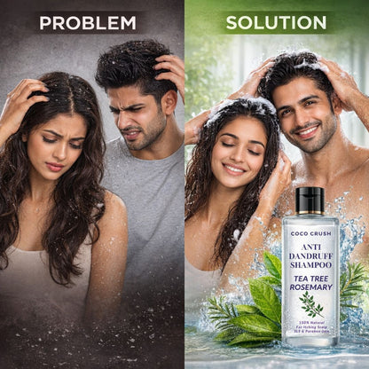 Coco Crush Anti Dandruff & Itch Shampoo for Teens, Adults