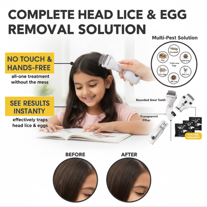 Coco Crush Electric Lice Comb with Suction | Chemical-Free & Reusable